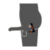 Remote Controlled Prostate Plug